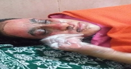 রাজশাহীতে স্কুল শিক্ষক স্ত্রীর শরীরে কেরোসিন ঢেলে আগুন